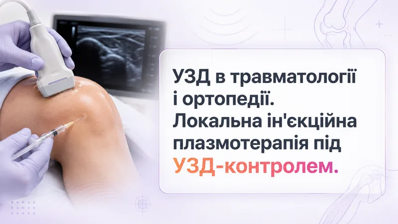 УЗД в травматології і ортопедії. Локальна ін'єкційна плазмотерапія під УЗД-контролем